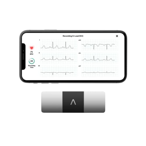 KardiaMobile Six-Lead Personal EKG Monitor - Detect AFib from Home