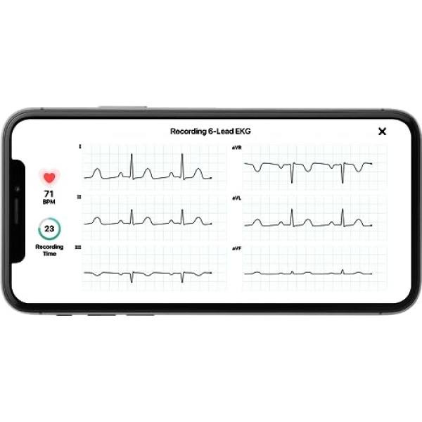 KardiaMobile Six-Lead Personal EKG Monitor - Detect AFib from Home - Image 5